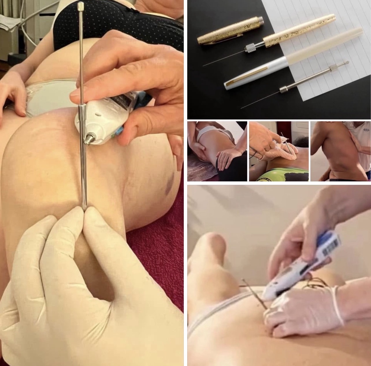 Technique et instruments dédiés