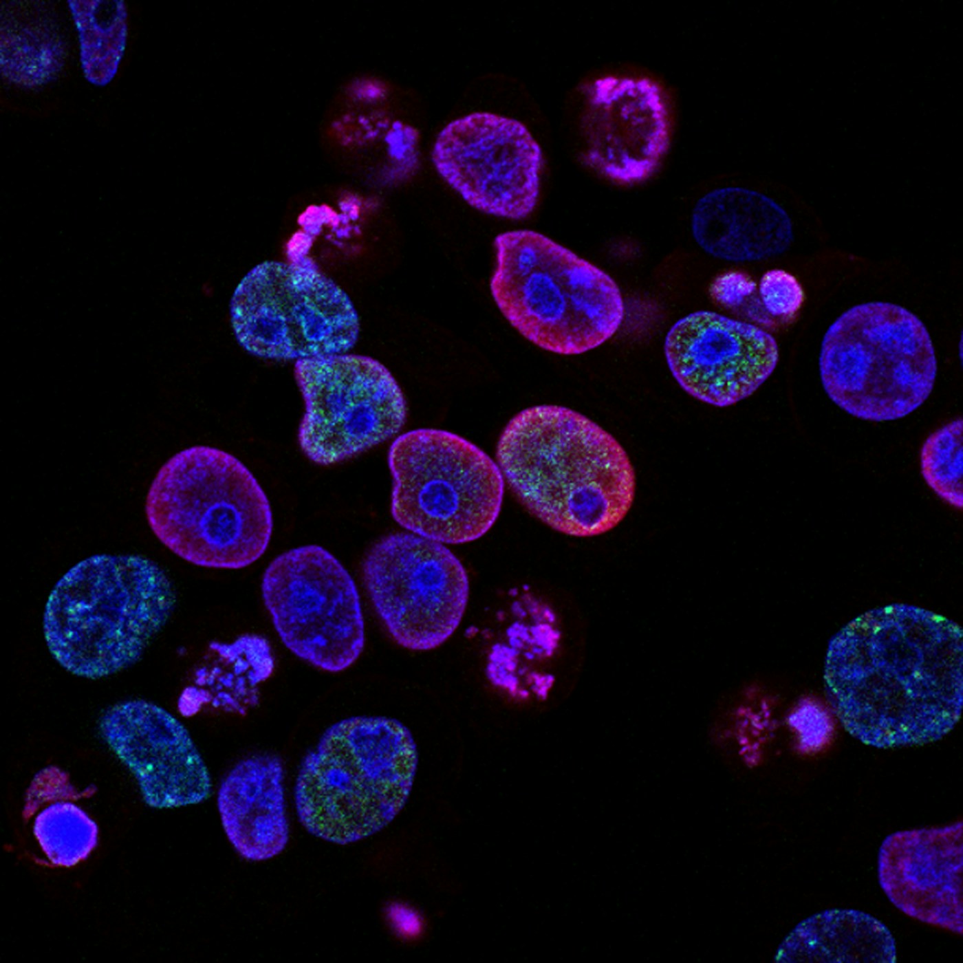 Visualisation conceptuelle en mouvement de la communication entre cellules immunitaires